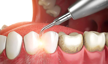 non-surgical